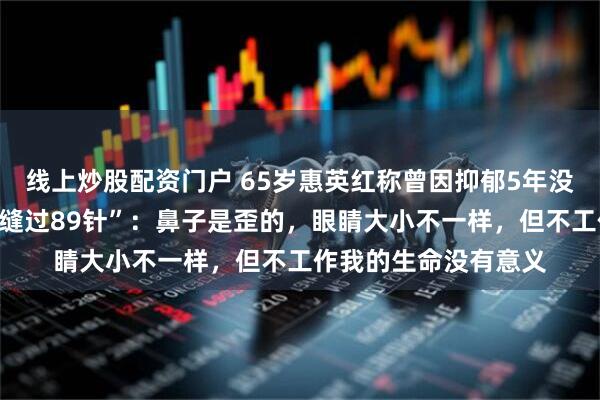 线上炒股配资门户 65岁惠英红称曾因抑郁5年没法出门,回应“脸上缝过89针”:鼻子是歪的,眼睛大小不一样,但不工作我的生命没有意义